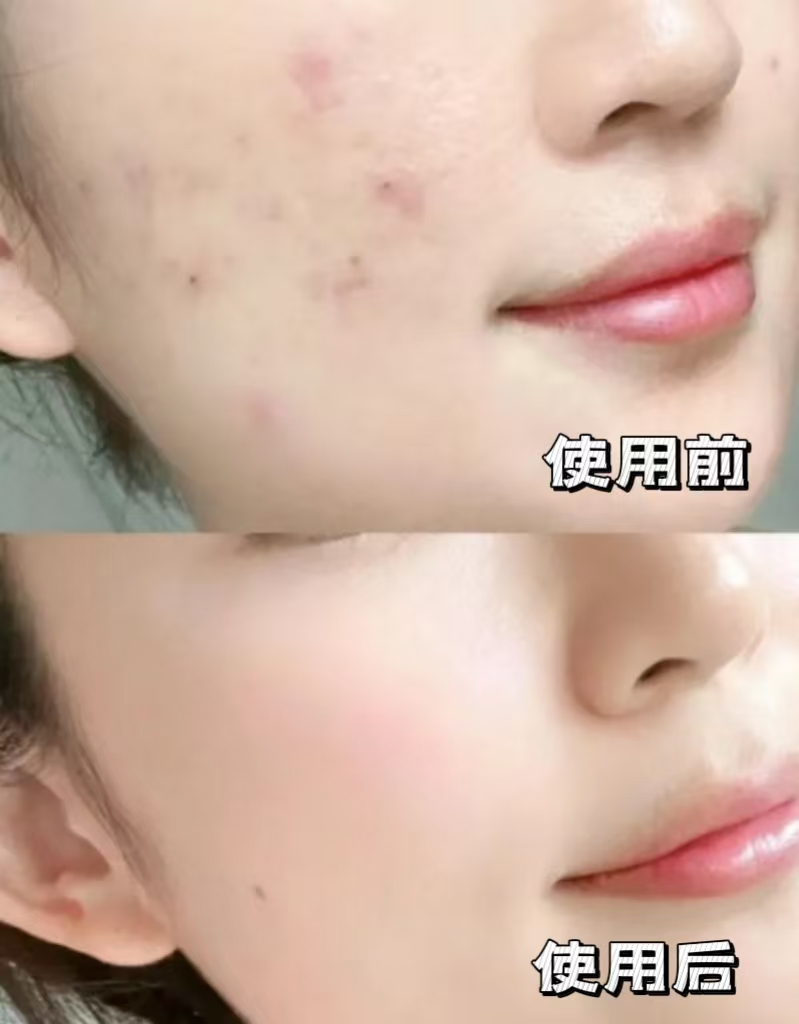 bbba376971e3bae2e446ef9f8aaa6c93