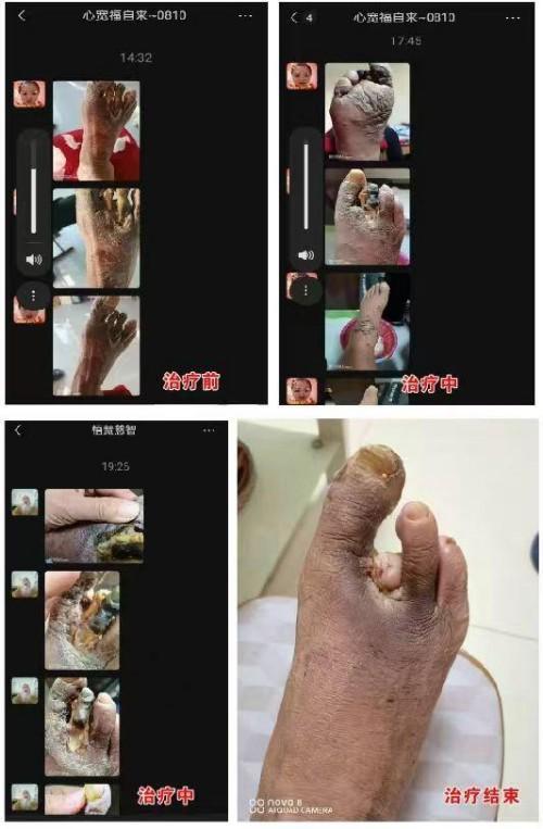 4ed127f3035278c29faabf45a4b0bc5a