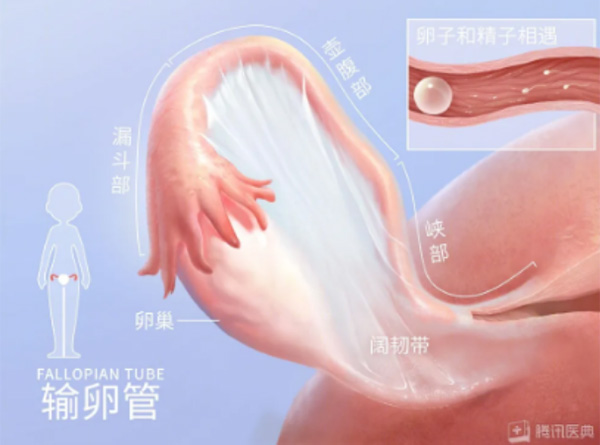 输卵管堵塞只能做试管？先别急，了解这些再做选择