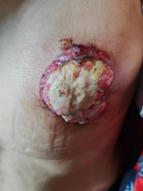 c3f37471cf2c6fe2aff0068b675b7096_