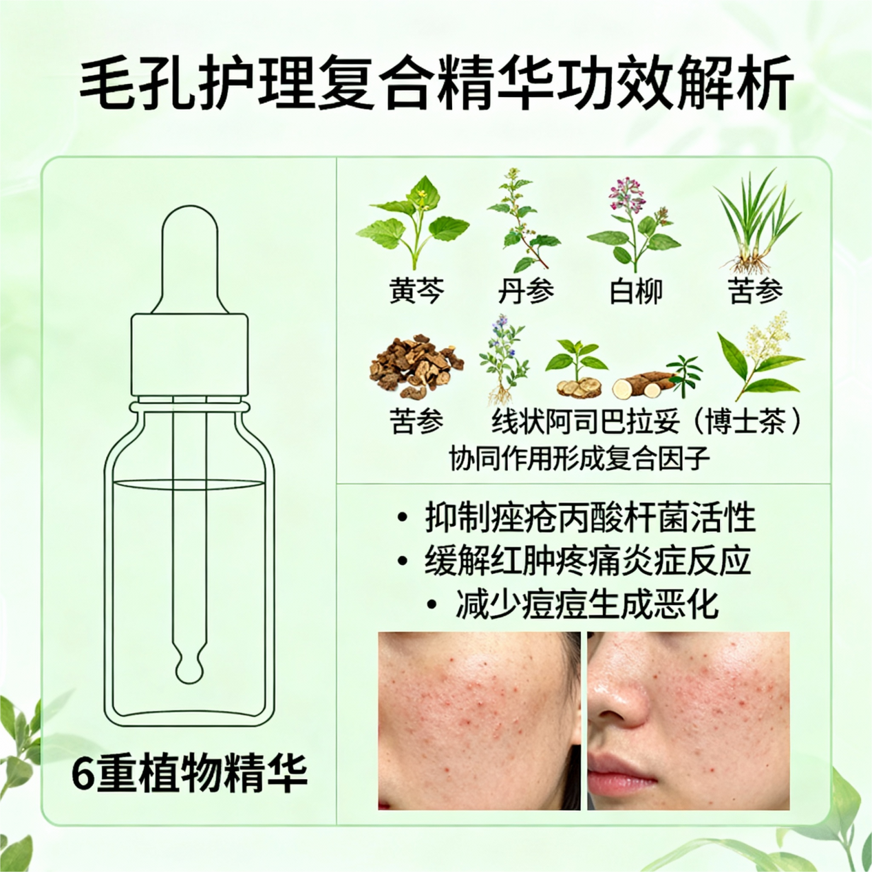 jimeng-2025-12-06-5224-疏通毛孔后，需要解决细菌滋生和炎症问题。精华中的6重植物精华（黄芩、丹参、白柳、...