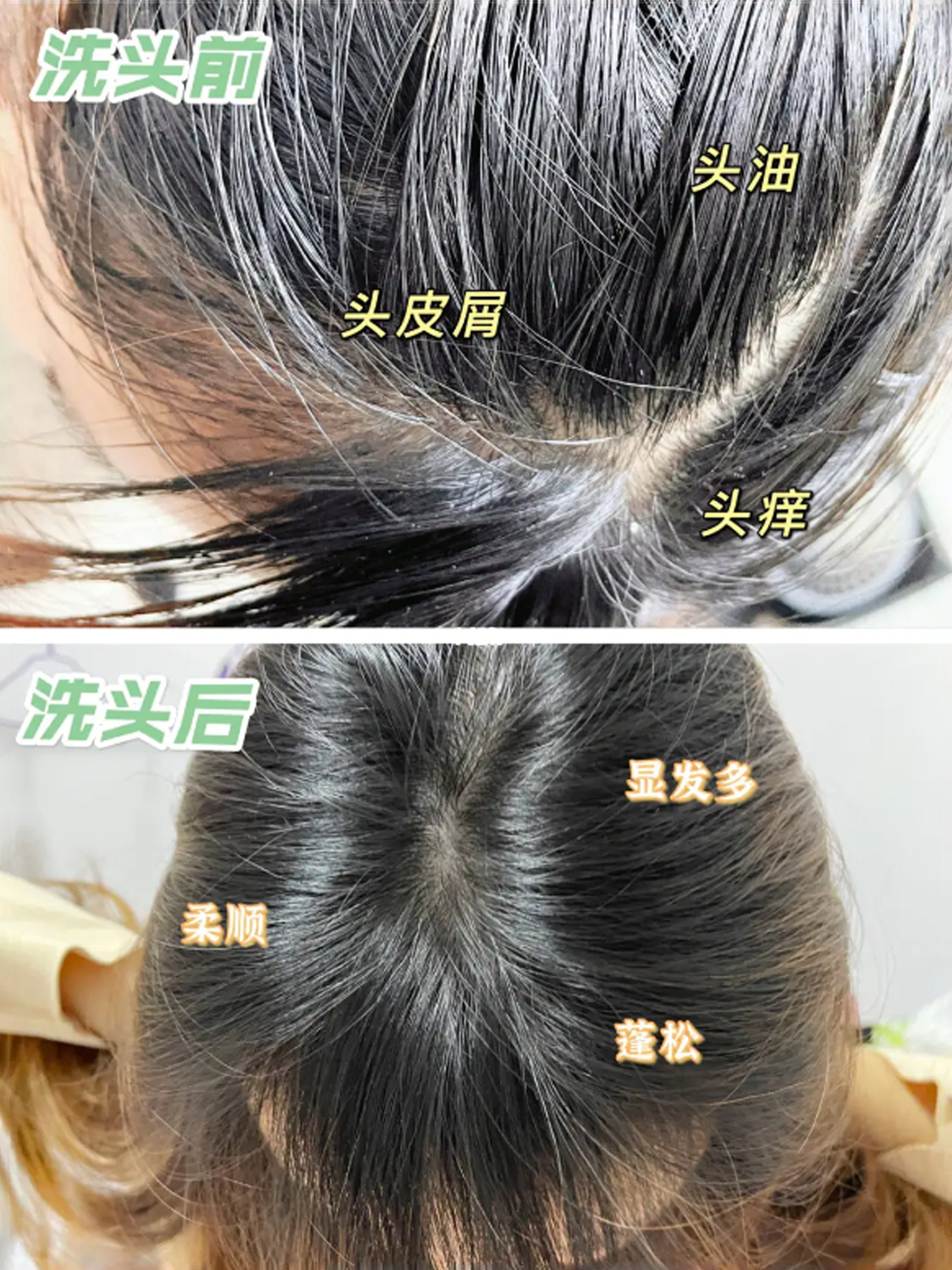 ʮ����ϴ��ˮʹ��ǰ��Ա�ͼ��ʹ��ǰ����ͷ�͡�ͷм��ͷ�����⣻ʹ�ú���Ч����ȥмֹ����ͷ�������˳�����ɡ��Է��࣬���ͷƤ���ţ�������ˬ��­�����͡�