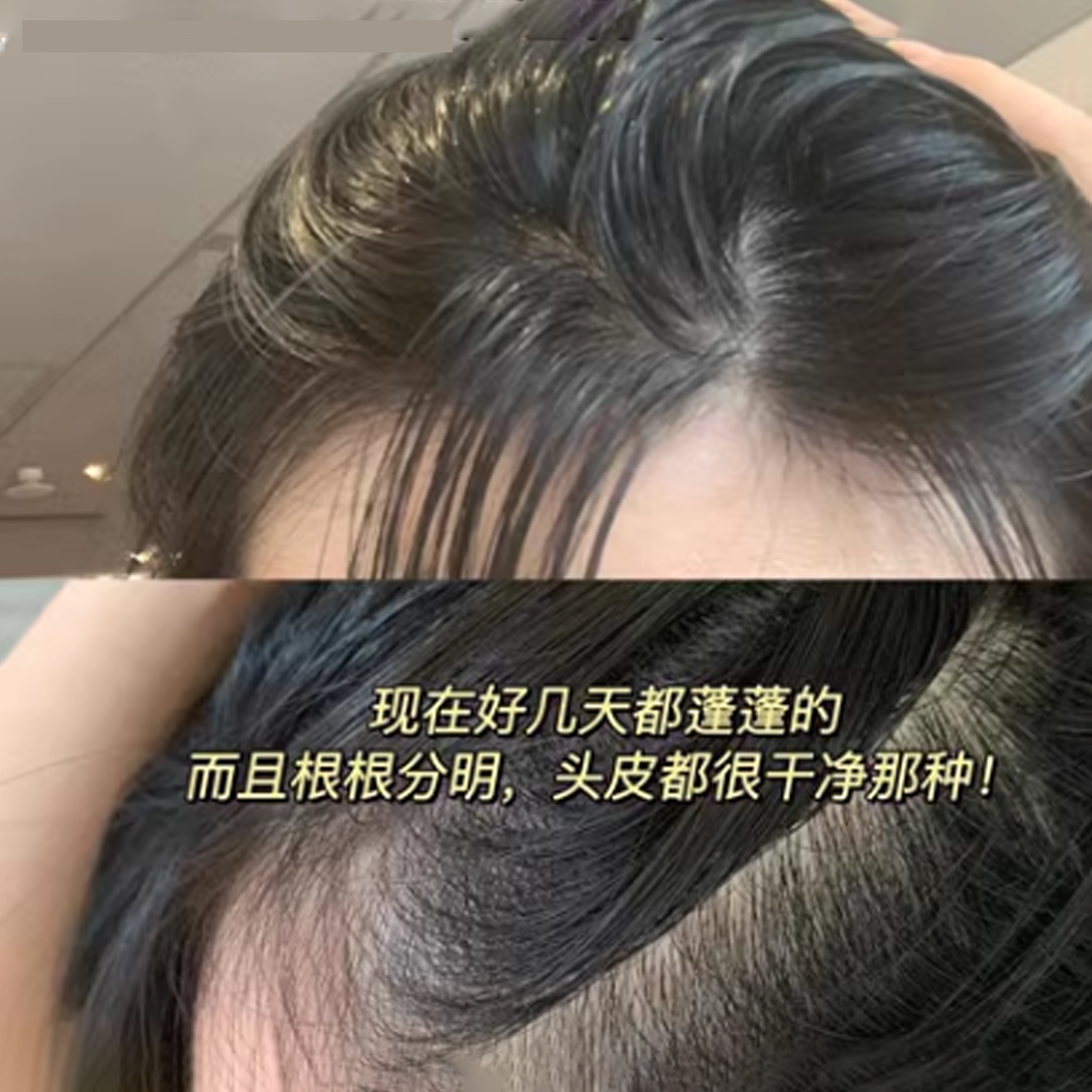 ʮ����ϴ��ˮ��Ч����ȥмЧ��ʵ�ģ�ʹ�ú�ü���ͷ���������ɣ�����������ͷƤ�ɾ���ˬ�������ͷ��������Ч������ˬ״̬��