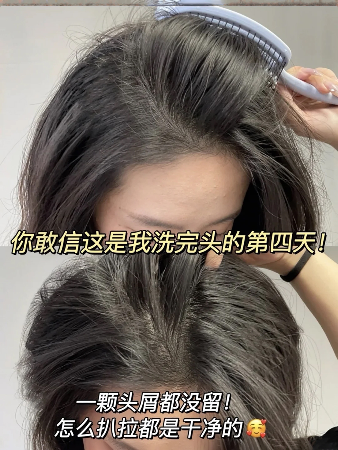 十芳清洗发水长效去屑效果实拍：洗完头第四天，一颗头屑都没留，怎么扒拉都是干净的，长效控油去屑，告别头屑反复，头发清爽干净
