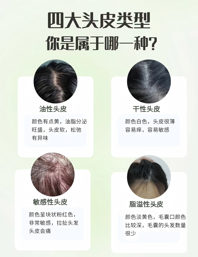 9930a5cbd03970ccf406d613261d405a